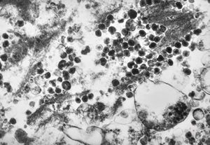 herpes virus in tissue culture herpes virus in tissue culture